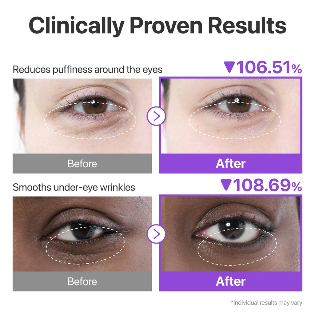 Numbuzin No.9 NAD Collagen Under Eye Patches - texture