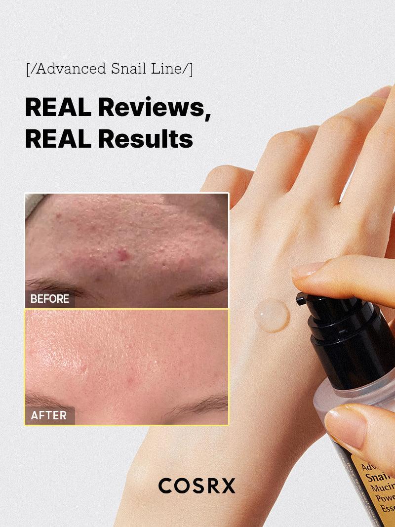 COSRX Advanced Snail 96 Mucin Power Essence - results